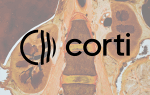 Corti Assistant for Mobile imagery